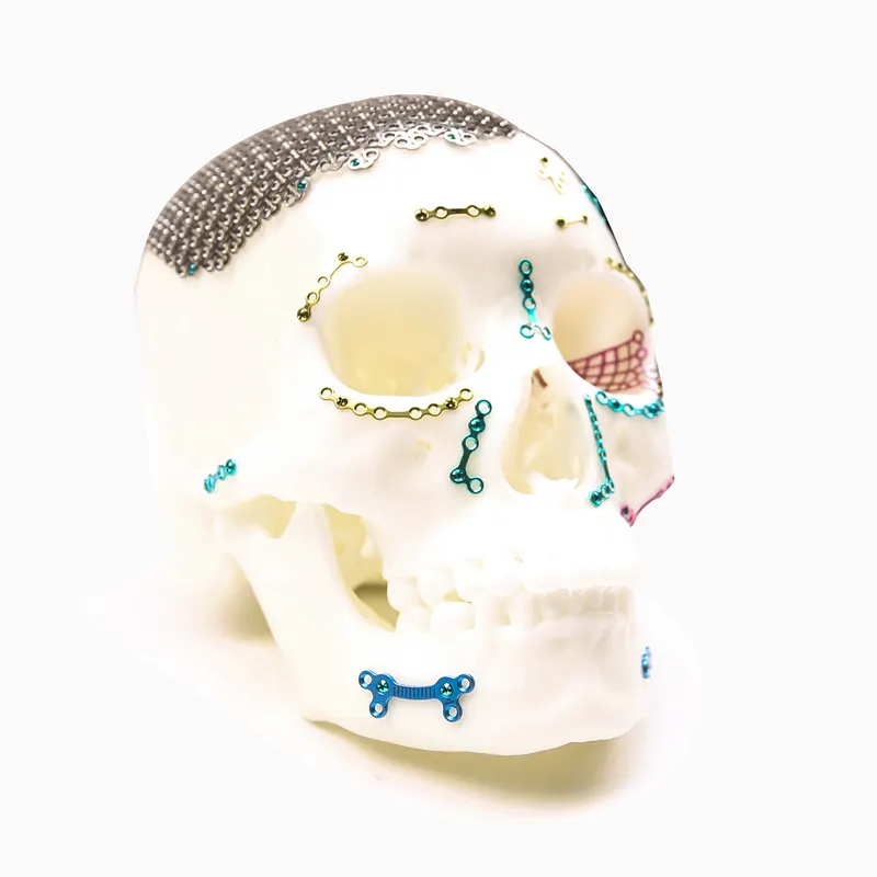 Skull-shaped anatomical display model in right-facing three-quarter profile with a dark perforated cranial mesh and coloured fixation components.