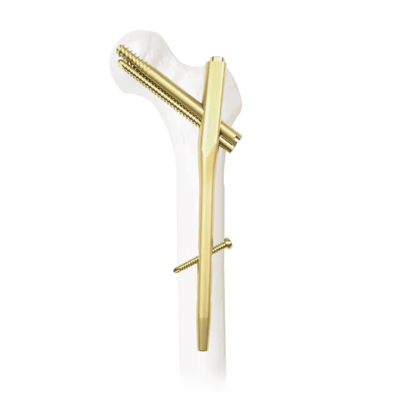Elongated gold-coloured nail with two threaded screws positioned vertically through a translucent proximal femur and shaft.