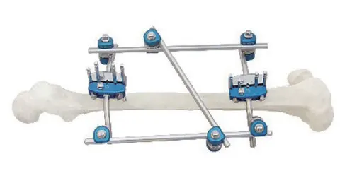Half-ring standard external fixator with a curved ring section carried on paired rods