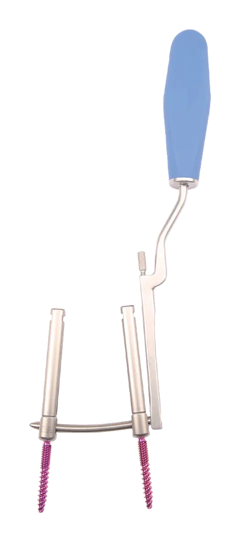 Blue-handled instrument engaging a curved rod carried between two parallel screw extender tubes, with a purple threaded screw at the lower end of each tube