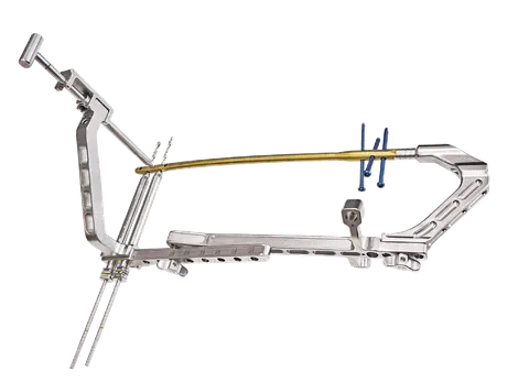 Retrograde femoral aiming frame with the nail coupled to its insertion handle