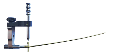 Aiming frame clamped over a guide wire and drill sleeve, assembled for ulnar nail insertion