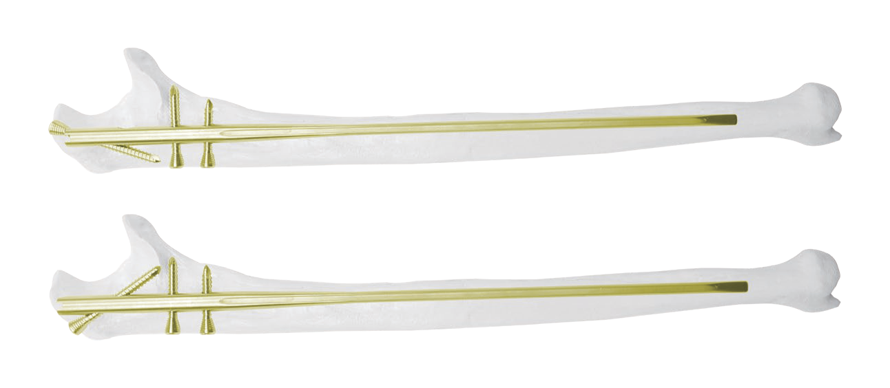 Two stacked computer-rendered views show elongated white bone-shaped forms with central pale-gold shafts, widened ends, and an upward-curving projection on black