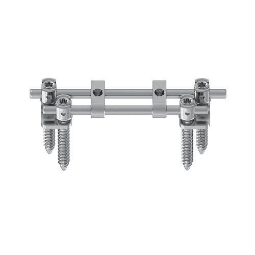 KSS-II 5.5 Anterior Thoracolumbar Double Rods System