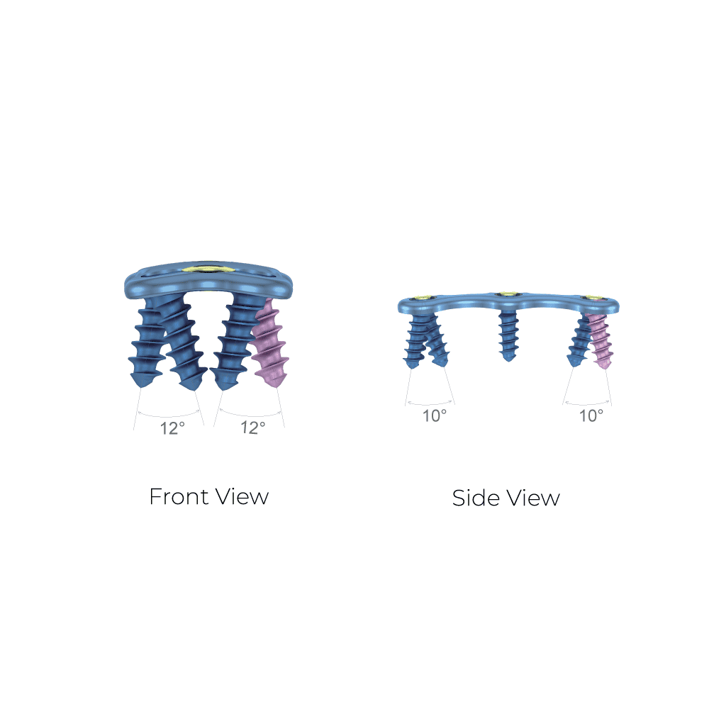 Anterior Cervical Plate-II System