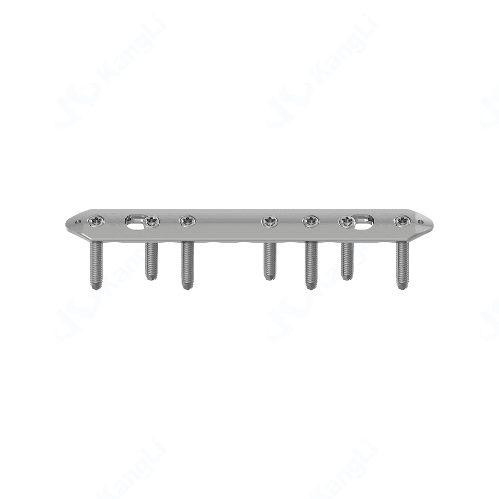 Tibial Locking Plate