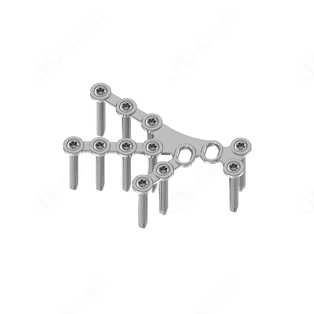 Calcaneus Locking Plate-II (Short Tail)