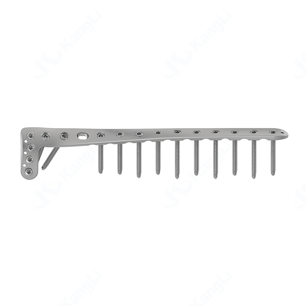 Distal Anterolateral Tibial Locking Plate